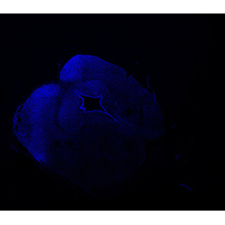 11PCW human midbrain